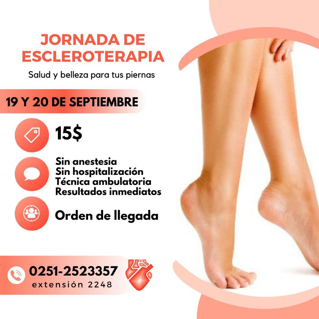 📢 Asiste este lunes 19 y martes 20 de septiembre donde contaremos con una jornada de escleroterapia, técnica aplicada por especialistas para el tratamiento de venas varicosas y las famosas arañitas... Trae tu orden médica. #ascardio #angiologia #escleroterapia #jornada