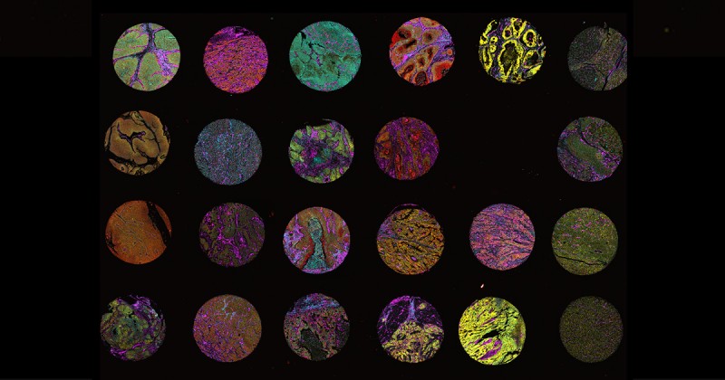 Come see us at the Spatial Biology conference in Boston, Sept. 15-16! Our specialists will be on hand to answer all of your questions about multiplexing with Cell DIVE. oxfordglobal.co.uk/spatial-biolog…