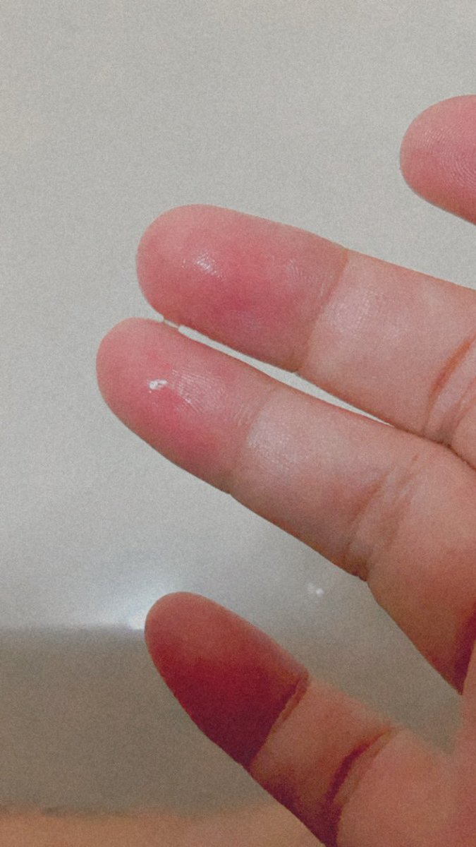 devilnpd's tweet photo. น้ำเต็มมือเลย https://t.co/u8I9pWcdx4