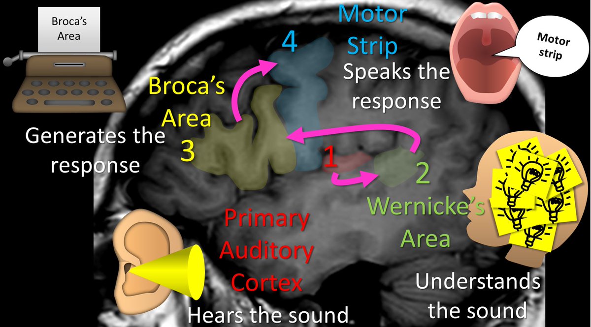 teachplaygrub's tweet photo. Talk about an important circuit! The basic structure of the language circuit of (1)hear (2)understand &amp; (3)respond is outdated but still helpful to remember where important eloquent cortex is located
#medtwitter #FOAMed #FOAMrad #medstudent #neurorad #radres #meded #Neurosurgery https://t.co/pPjs5lHnOH