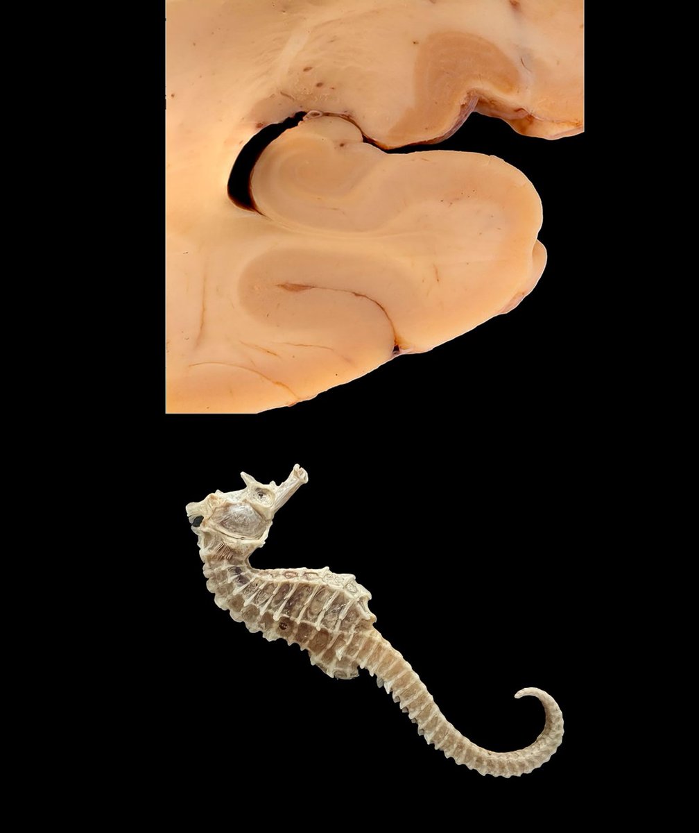 The hippocampus (or hippocampal formation) 
#Neuroanatomy #neurotwitter #neuroanat2022