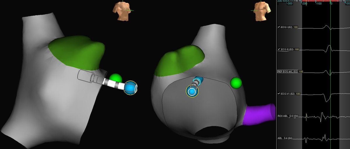 Kai Harrison tweet media