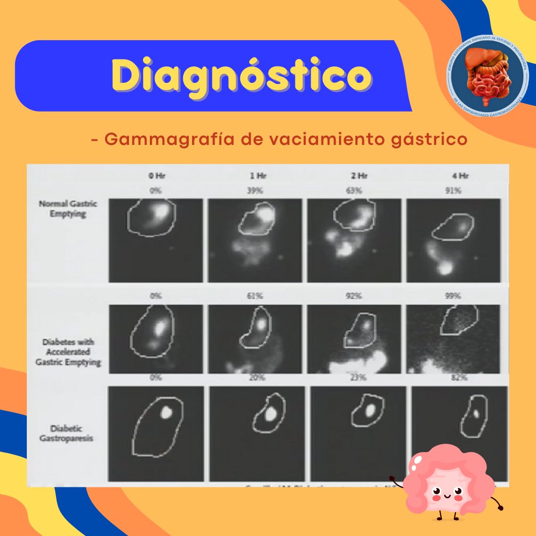 GEPEG5's tweet photo. Te compartimos este post de nuestro tema de la semana: Gastroparesia 🧡💙
¿Ya conocías esta enfermedad?…
#GEPEG #FACMED #SEASE #ALINTESTINOYMASALLA https://t.co/cg5FlRJqGu