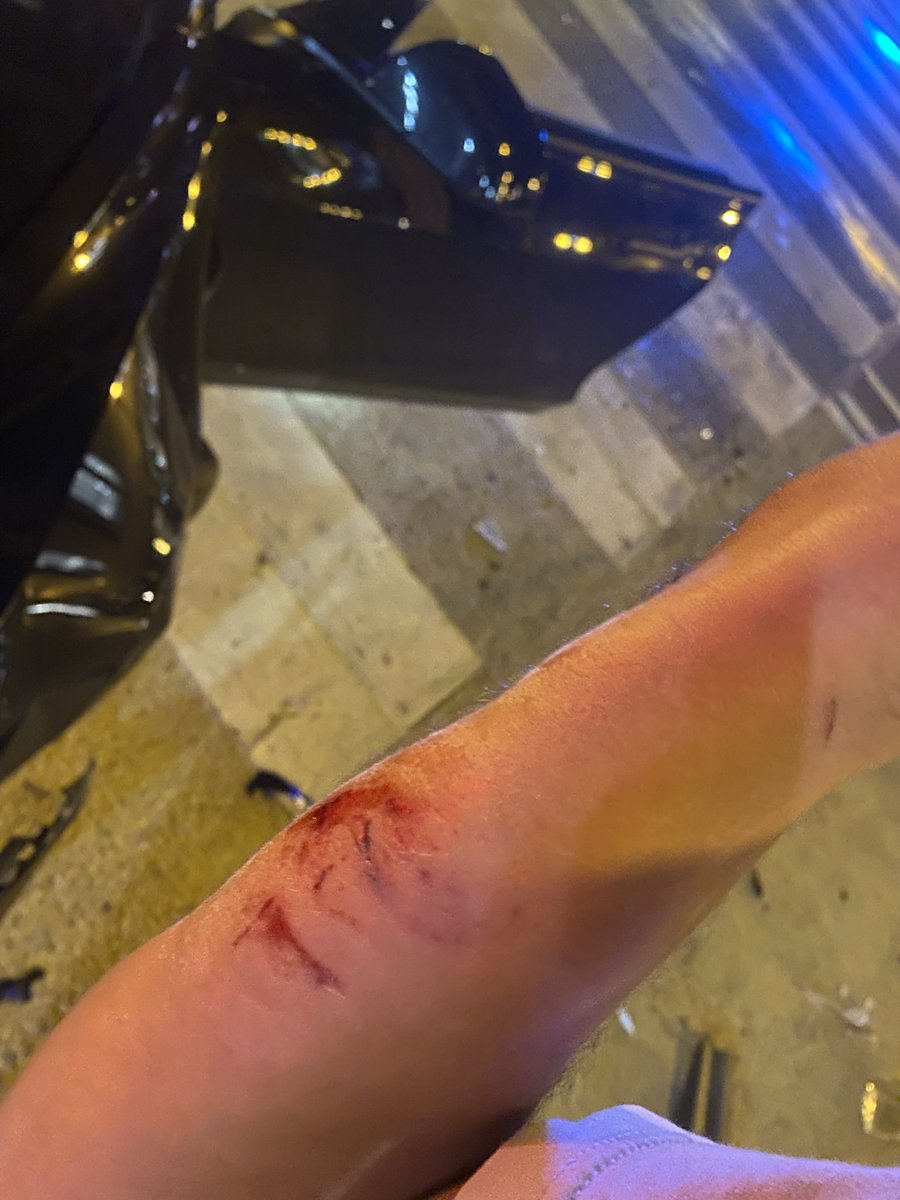 Sense2017's tweet photo. It feels good to be alive. Last weekend somebody flew thru a red light and hit my car. I did my best to swerve but it could have been worse. I was able to walk away. Subhanallah! Never take life for granted https://t.co/yw7X0WcGTO