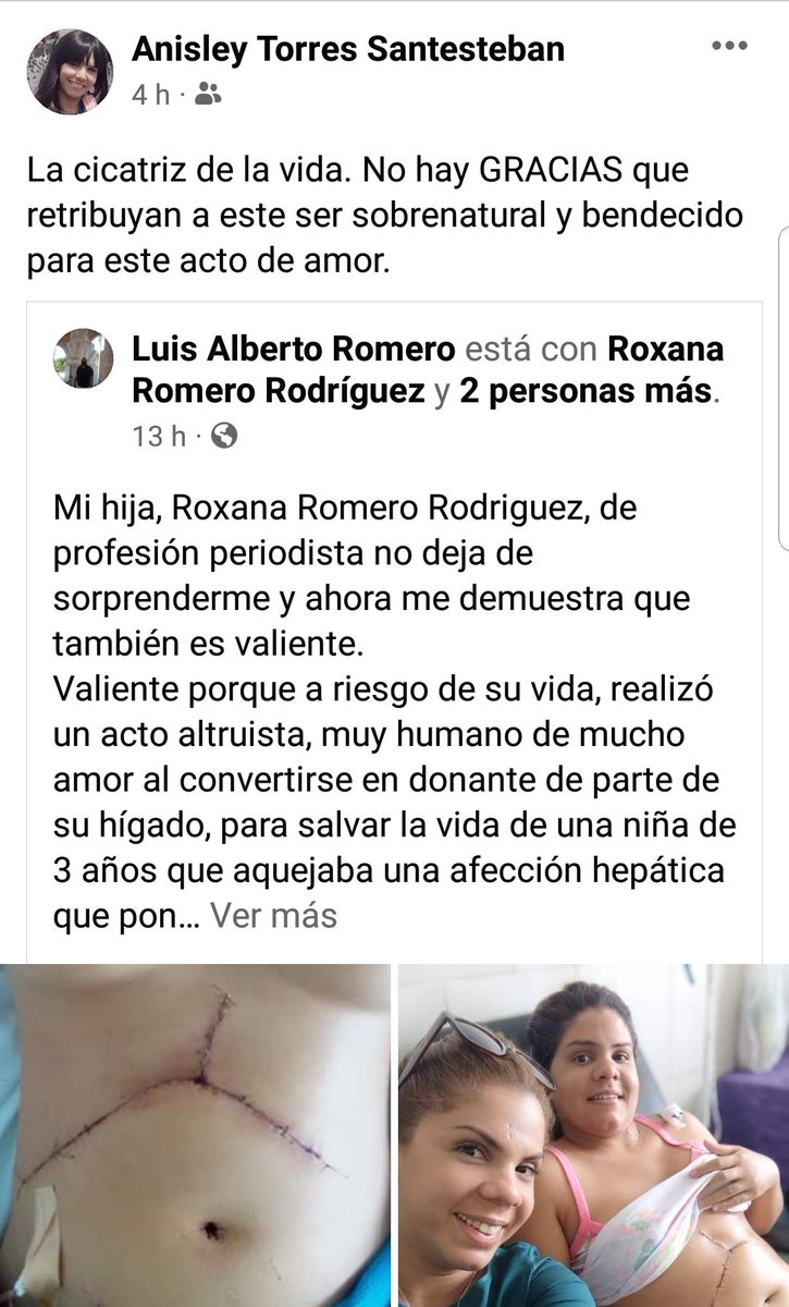 DiazCanelB's tweet photo. Hoy las redes no paran de hablar de @Roxa_RomRdguez, joven que donó parte de su hígado a una niña de tres años. Historia de valentía y altruismo que nos habla de la #Cuba que somos. La de la solidaridad, la del amor, la que se pone siempre en la piel del otro. Gracias, Roxana. https://t.co/ryAHpBOtcM