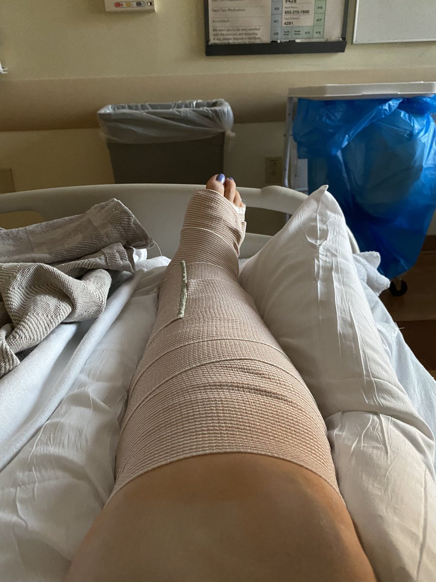 NursNtraining's tweet photo. So yesterday afternoon I had an accident. Ended up dislocating my tibia and breaking my fibula. Worse pain ever. Had surgery today to get some pins and plates. Thoughts &amp; hugs appreciated!! Thanks! 🤖❤️♾️ #BHFamily @DonnieWahlberg @NKOTB 😩😩 https://t.co/m0NOed0foZ