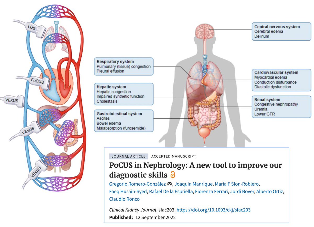 ralcazara's tweet photo. Mucho más sobre #PoCUS en nefrología. Revisado en CKJ - https://t.co/et2vNNcXOd - "PoCUS in the hands of a nephrologist is a precision medicine tool"
@SENefrologia @SOMANEorg #Nefro_8_01 https://t.co/D4mSbTOIZS