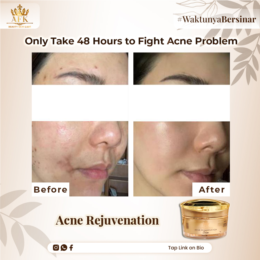 AFK Beauty Skincare tweet media