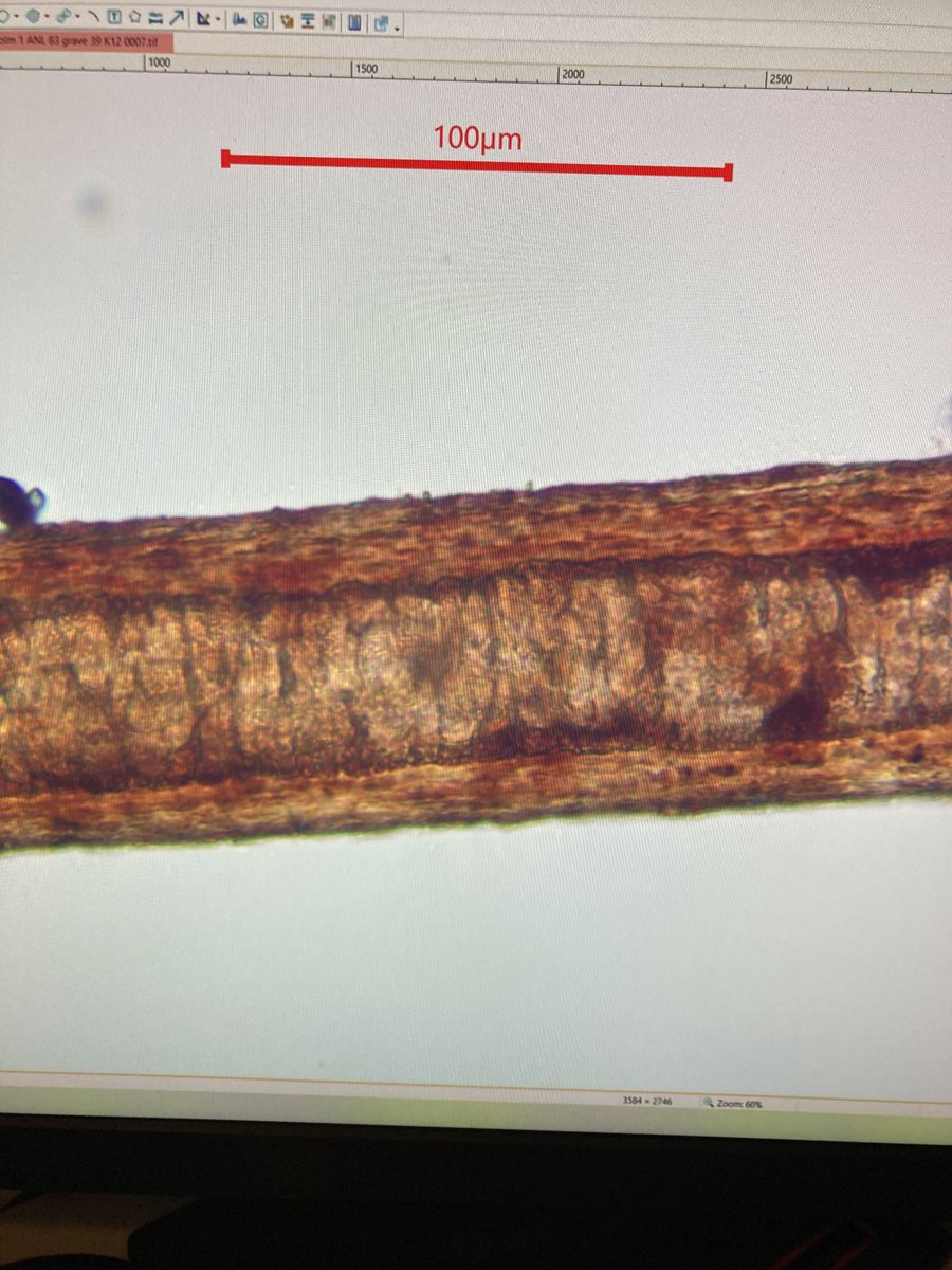 TKirkinen's tweet photo. Several predator hairs, feathers, pollen and phytolits from grave 39 in #Mesolithic #Skateholm #soil_samples @AMI_Research @HYhumtdk @helsinkiuni https://t.co/pnjTHBEB0x