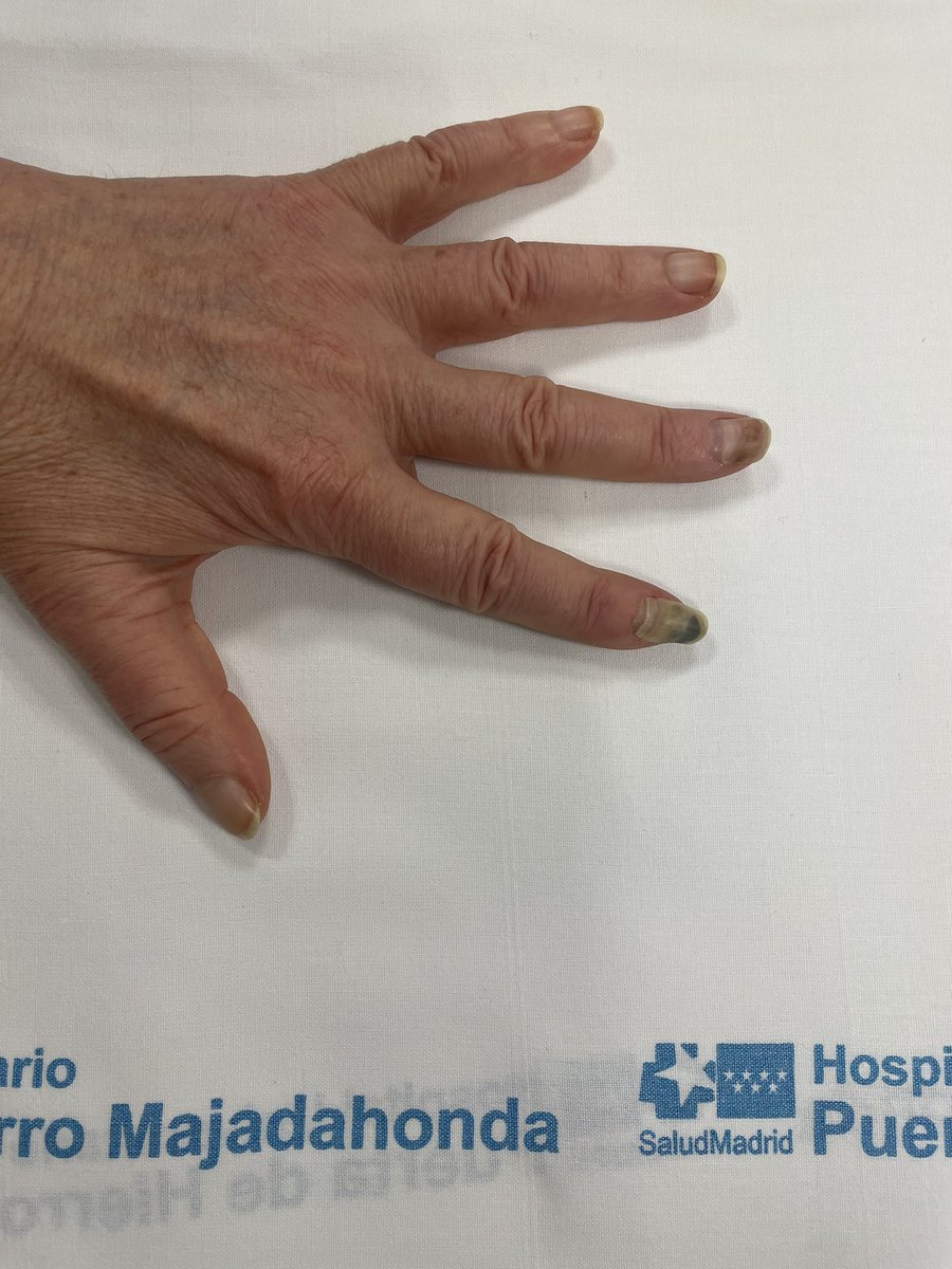 Dr. Mendiola de la Osa tweet media