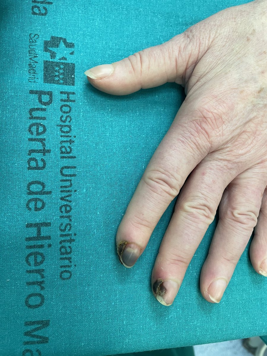 Dr. Mendiola de la Osa tweet media