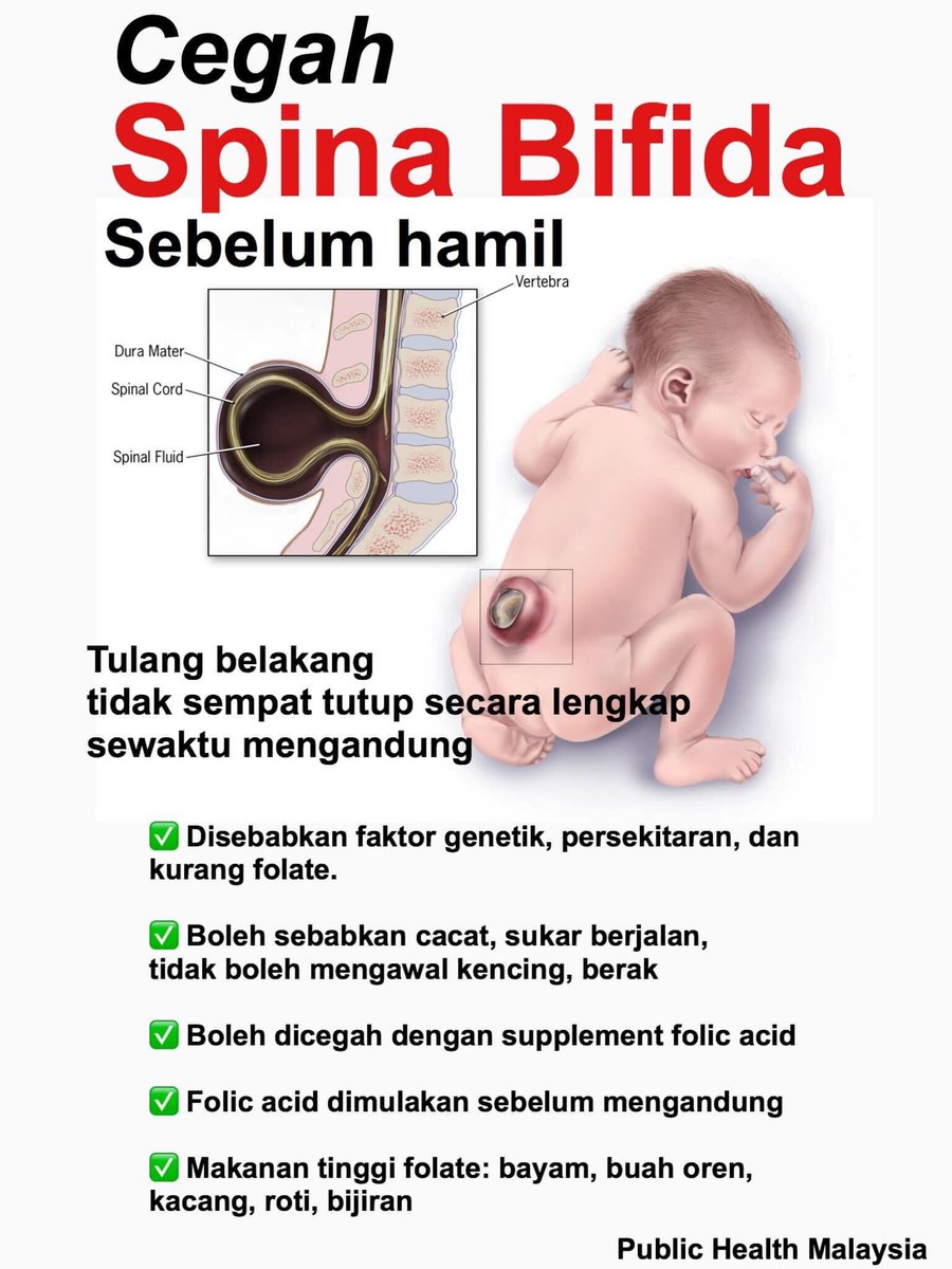 DoktorSamhan's tweet photo. “Doktor, saya mengandung. Apa pentingnya folic acid? Saya kadang makan ,kadang tidak.Lupa. Maklumlah lupa nak bawa dan sibuk bekerja”

“Ok baik, saya cuba terangkan” https://t.co/qcEXchcOL1
