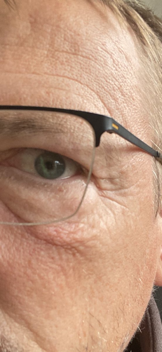 JanDeleuran's tweet photo. Rynkernes befrielsesfront
Jeg er kommet i en alder, hvor huden begynder at se noget slidt ud. 
Det syntes jeg er OK
For den har faktisk oplevet meget. Det er min patina. 
Det er en skam TV ikke må vise den slags, for nu er de blevet tabu. #rynker #tabu #grimt https://t.co/9AG0zLbaWe