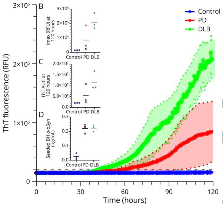 ScienceofPD's tweet photo. Interesting - New report from @OAgnaf &amp; colleagues reports combining seed amplification assay &amp; ELISA assays is a promising diagnostic tool for #Parkinsons, providing information about the disease stage by correlating with clinical measures of severity
https://t.co/4hzUmJP48F https://t.co/YqQRU7QE1O