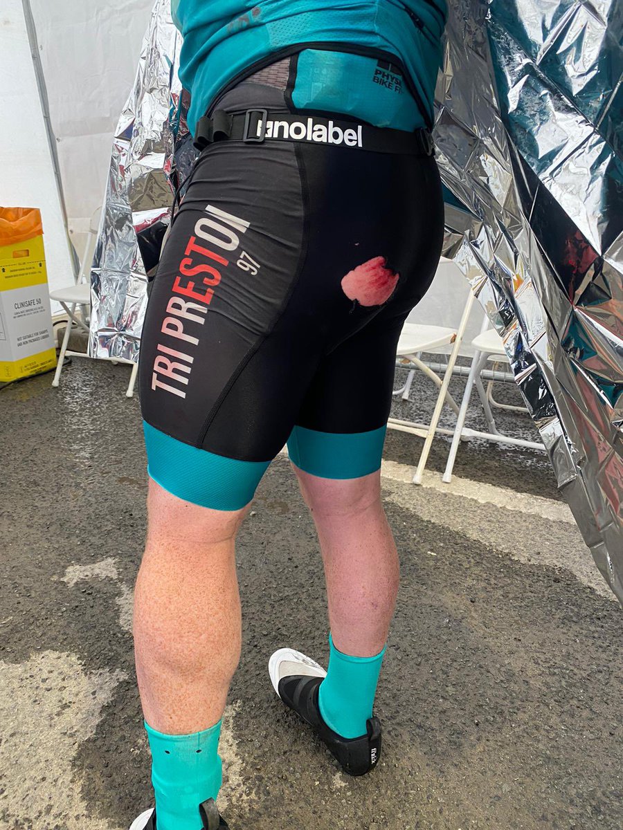 Not a good day when you crash out of Ironman 169k into the 180k bike leg. Didn’t make the run, coming off the bike at 55kph on a steep descent in the rain.Very lucky nothing worse than a grazed bum and cut elbow. IronMan Wales is epic though.I’ll be back for sure #Tenby #IMWALES
