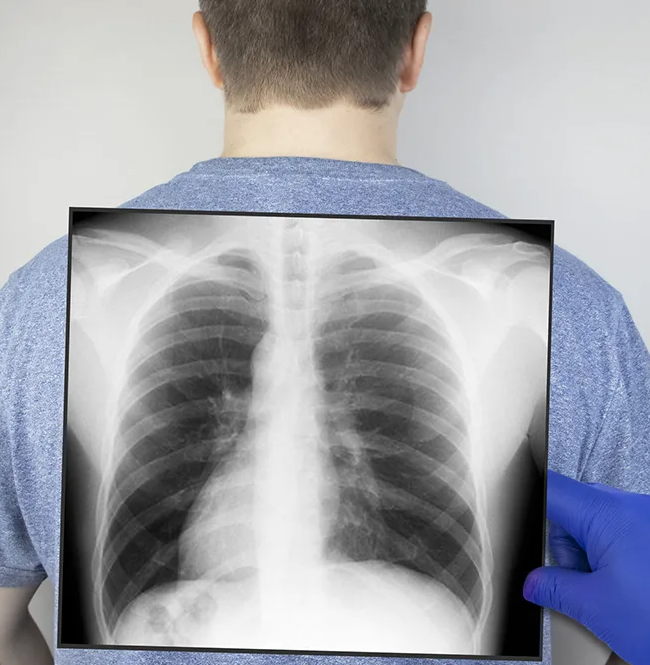 giblets_nft's tweet photo. Hello. We have thousands of unique lung X-rays. We will make 3 unique NFT collections. These images can be used by researchers, and this collection has a real value. Subscribe to our Twitter and get into the 200 lucky ones on the presale. #NFT #Airdrop #Ethereum #OpenSeaNFT https://t.co/gRiirDQoqy