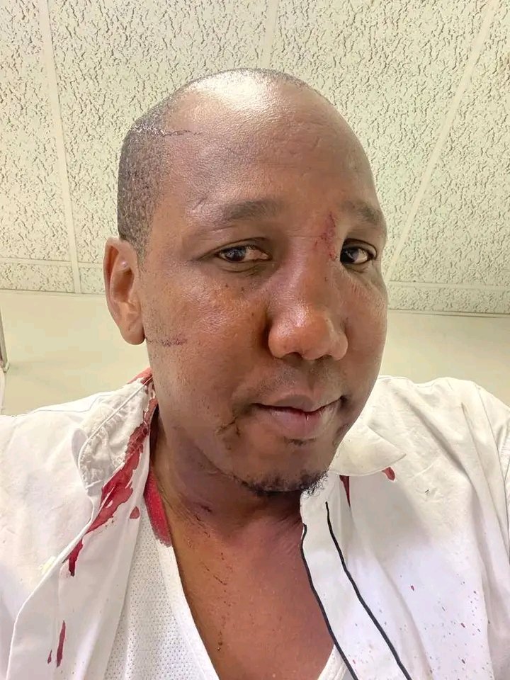 Taung_DailyNews's tweet photo. Breaking News: The Municipal Manager at Kagisano Molopo Local Municipality, Olaotswe Bojosinyane was allegedly assaulted by community members during a confrontation. https://t.co/LvFB3GHLyH