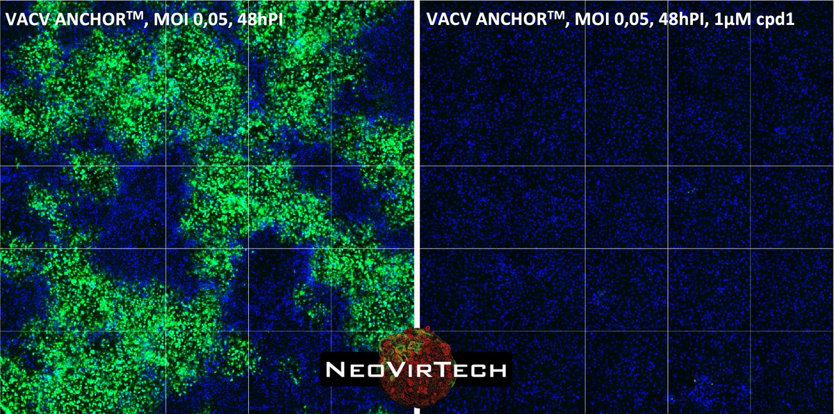 NeoVirTech (@neovirtech) on Twitter photo Fast and robust discovery of antipoxvirus inhibitors using ANCHOR tagged viruses. A 25 field reconstruction is shown for each condition (blue: nuclei, green: VACV ANCHOR), showing that compound 1 completely abolish virus replication. contact@neovirtech.com Fast and robust discovery of antipoxvirus inhibitors using ANCHOR tagged viruses. A 25 field reconstruction is shown for each condition (blue: nuclei, green: VACV ANCHOR), showing that compound 1 completely abolish virus replication. contact@neovirtech.com