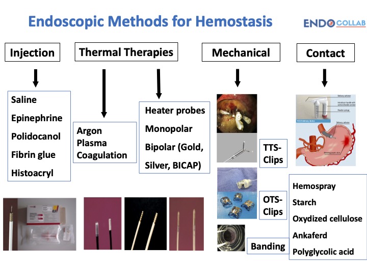 EndoCollab GI Endoscopy Community on Twitter "Endoscopic Methods for
