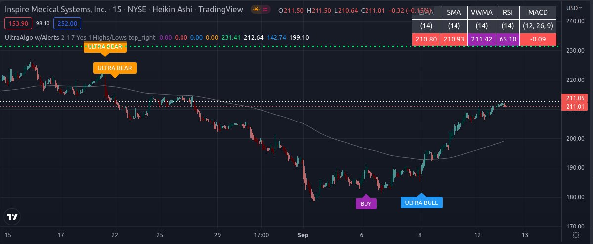 TradingView Chart for Inspire Medical Systems Inc