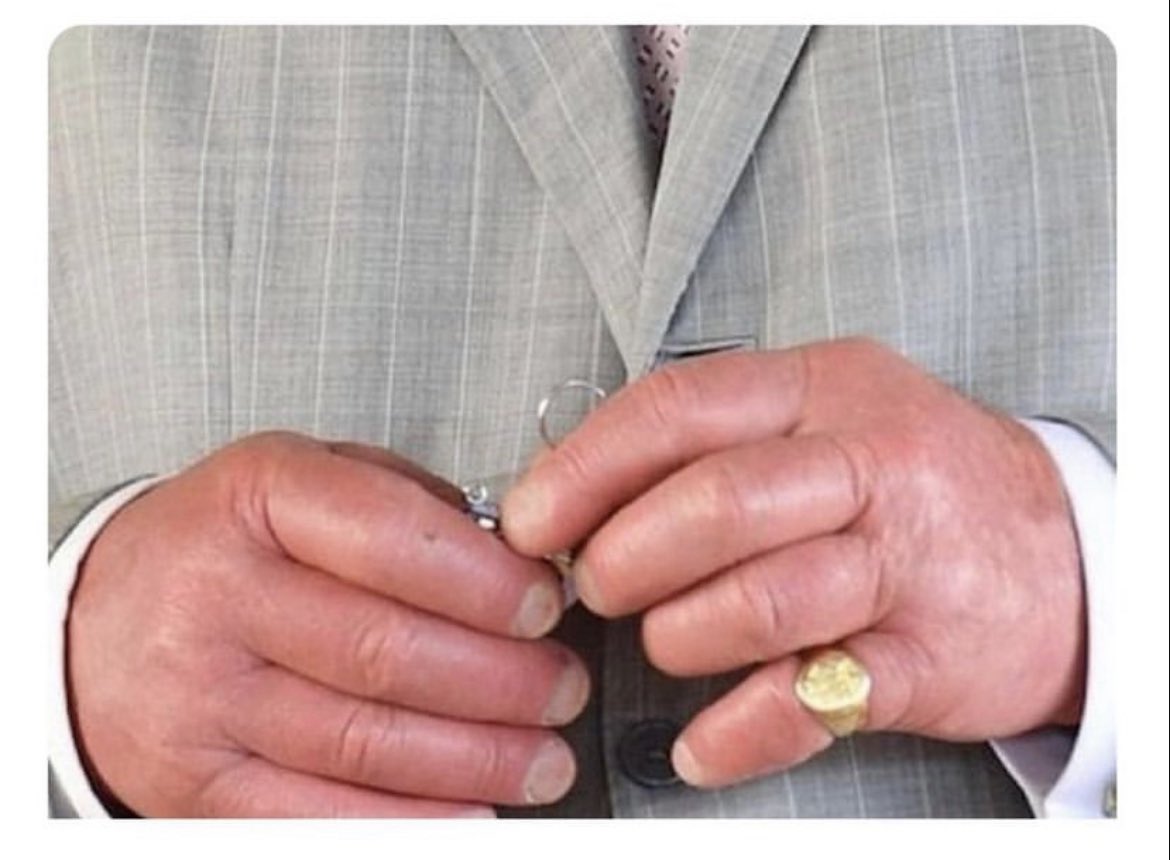 bradleesweeps's tweet photo. When the patient says they’re an easy stick but have these bad boys for hands https://t.co/Q68wVxDbsO