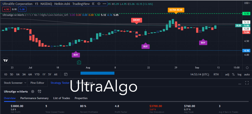 TradingView Chart for Ultralife Corporation