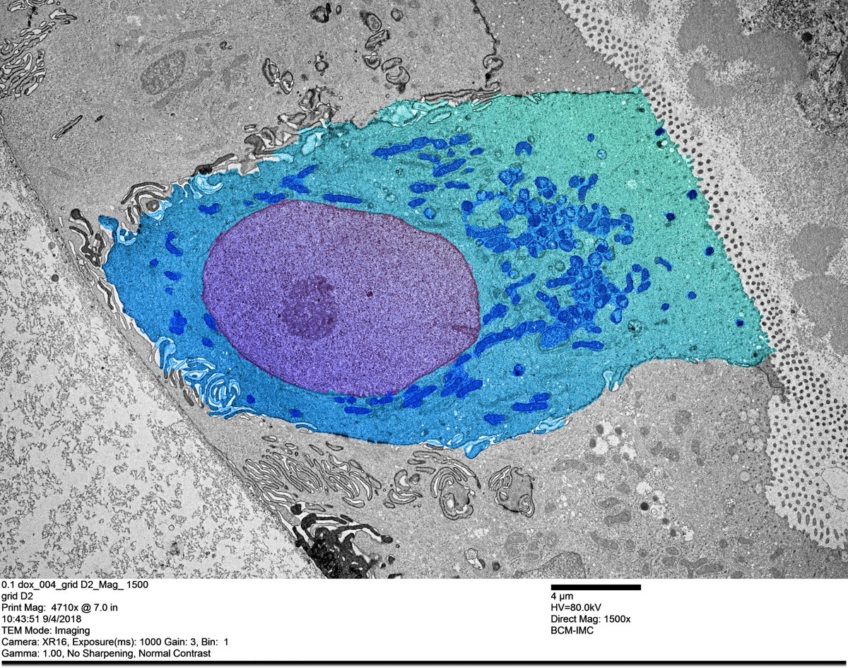micromindy's tweet photo. Joining in on #TEMTuesday! Here is an #enteroendocrine cell in human #intestinal #organoids 😊! #bioart #sciart #underthemicroscope #TEM #microscopy #enteroid #organoid https://t.co/6sLVxHnTpg