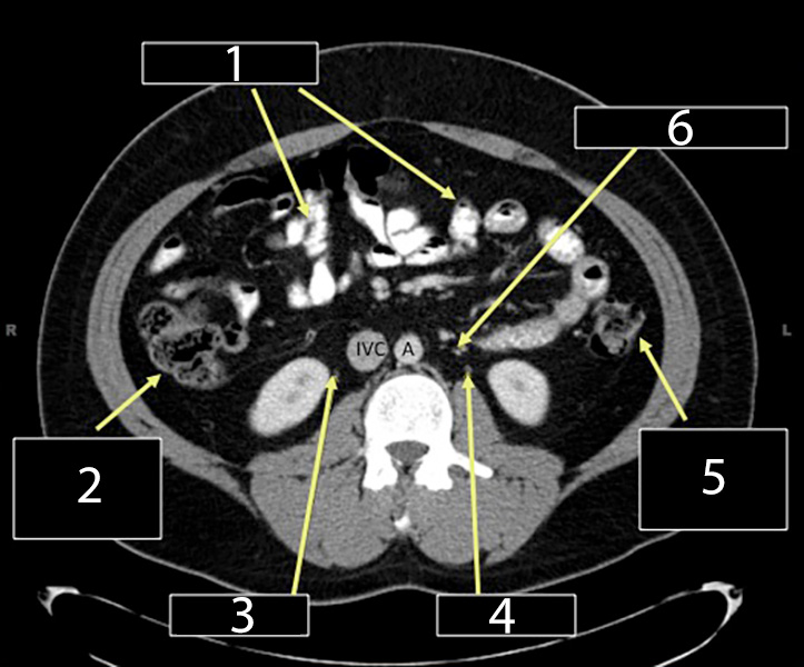 ctisus's tweet photo. Anatomy quiz: can you label 1-6? https://t.co/ff2DtBtvD3