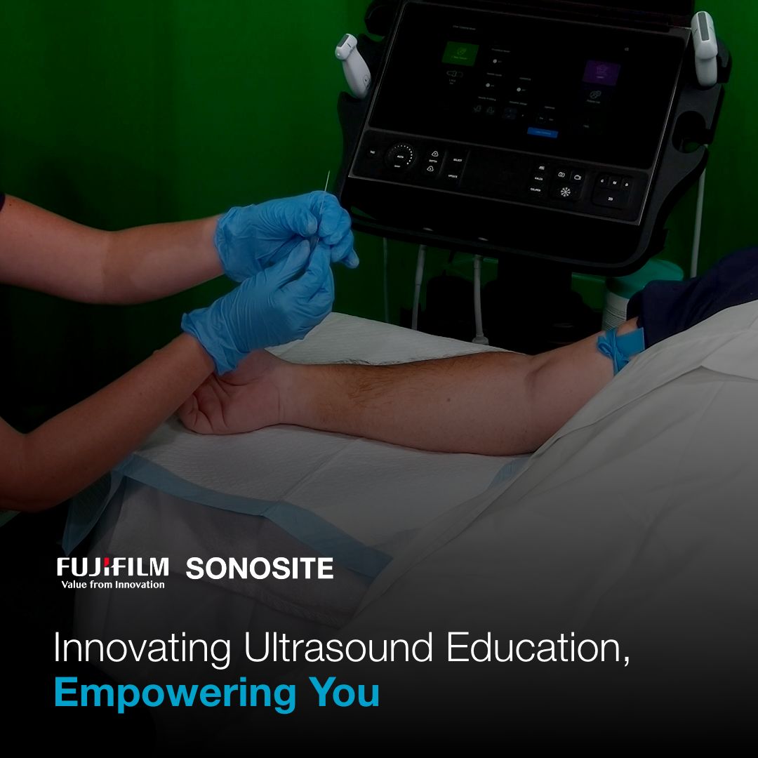 From FUJIFILM @Sonosite: Sonosite is dedicated to empowering and educating medical professionals about point-of-care #ultrasound. Here’s a peak #behindthescenes of our latest collaboration with peripheral IV experts! Explore POCUS education: lnkd.in/eErp7f-U #FOAMed