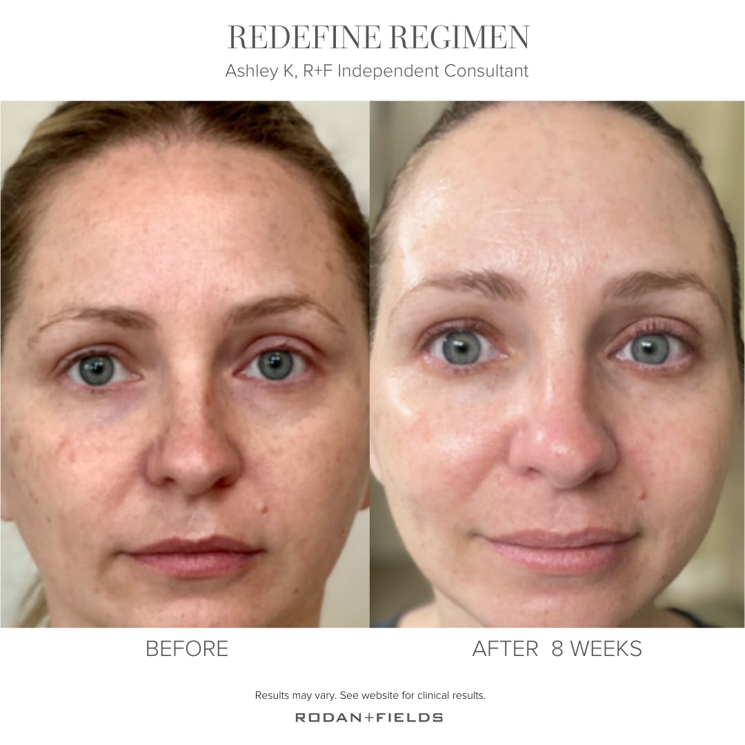 RPGolfFitness's tweet photo. Real people, real results! 
Which products are right for you?  Click the link below to take the skin solutions quiz and find out. https://t.co/a2VRFbaVOr https://t.co/SUTBSoqLut
