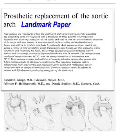 JCoselli_MD's tweet photo. It is heartbreaking to hear of the passing of a dear friend, Randall Griepp, MD. He was such an innovator and pioneer in aortic arch surgery. A legacy that will continue to live on. https://t.co/x10qgaJMRO