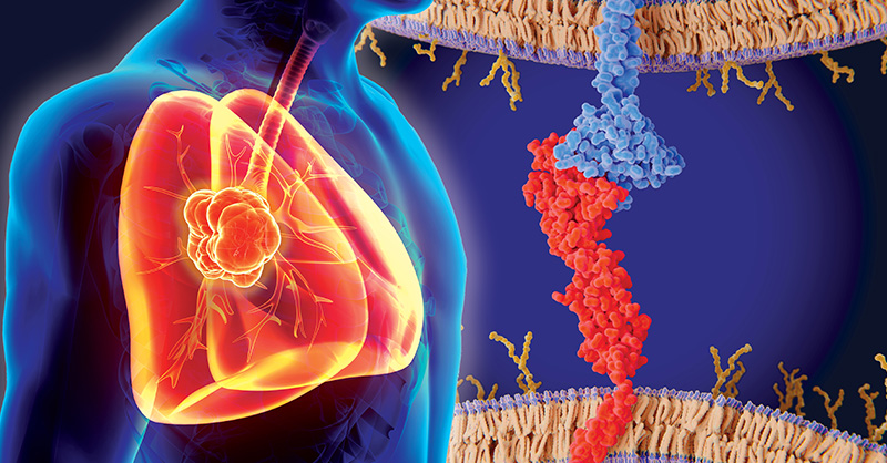 Learn to navigate the new evidence on perioperative #Immunotherapy, including neoadjuvant, adjuvant &amp; combined approaches, with Drs. Altorki (<a href="/AltorkiNasser/">nasser altorki</a>) &amp; Spicer on 9/30 at 6:30 PM EDT during #ThoracicSummit2022 bit.ly/PeriopLung22T #LungCancer #NSCLC #AATS <a href="/AATSHQ/">AATS</a>