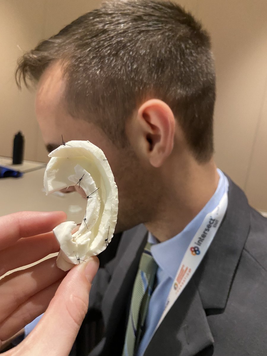 JackieTucker07's tweet photo. I had so much fun yesterday in the microtia simulation session @AAOHNS ! Thanks for modeling @LorenzJeff12. I have a new appreciation for rib carving! #OTOMTG22 https://t.co/iZCRxajATE