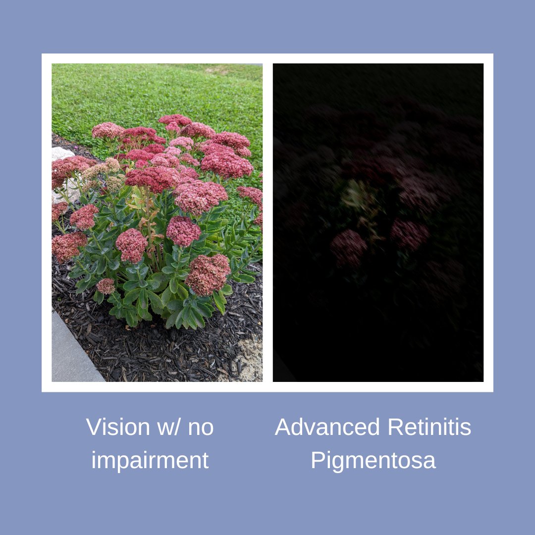 TheIrisNetwork1's tweet photo. For someone with vision impairment, depending on their condition this is what they could see. @TheIrisNetwork1 provides individualized programs and services tailored to the needs and goals of each person. #VisionWithNoLimits https://t.co/tb8GNShere