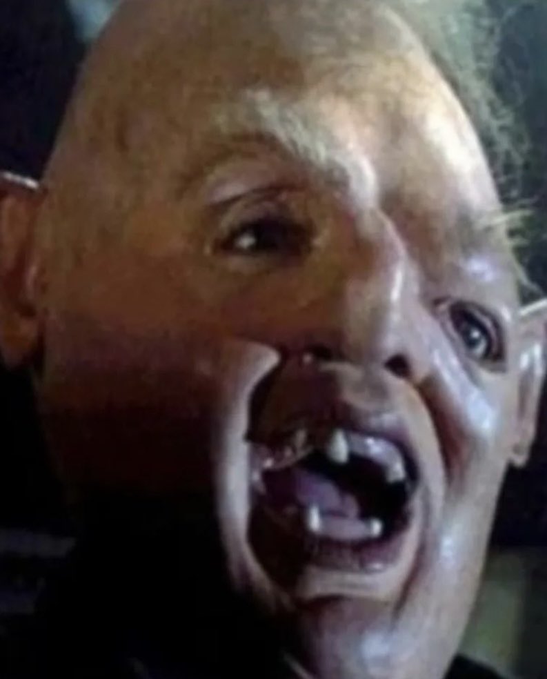 How raider fans look when they yell “raaiiiderrrsss” lol