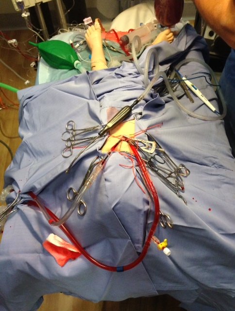 StarshipSimProg's tweet photo. Learnings from PICU ECMO simulations pictured have translated into improved care for our paediatric and neonatal patients #ipsssimweek #hcsimweek22 https://t.co/TjszDq2zwc