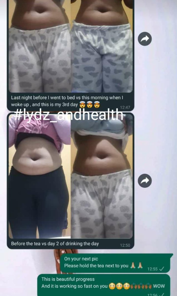 itsLydiaHoney's tweet photo. A pack of the tea costs R350
Give it a try
๐ฒ +27 (65) 977 2593
๐ https://t.co/d40g3IxdUz
๐ Available world-wide
#ุง #ad #lydz_andhealth #FetchYourBody2022 #BapediMorningDrive #afterdark #messyspace #Loadshedding #Jagersfontein #RunningWithTumiSole #GirlTalkZA https://t.co/REUzTw1Kir