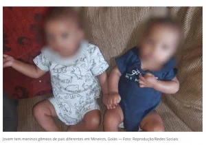 人体の不思議！ブラジルで父親の違う双子が産まれたそうです。