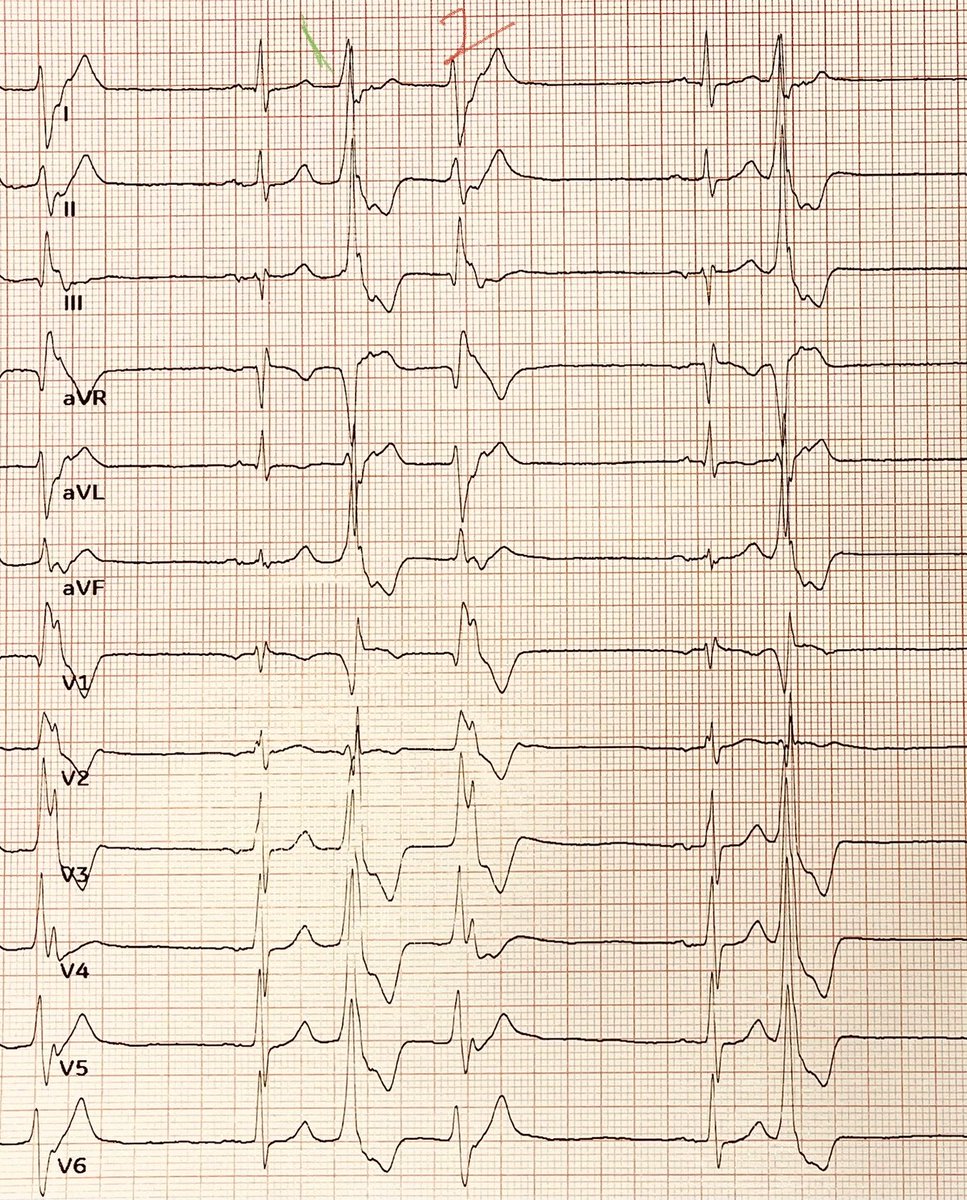 Anna Sarcon, M.D, FACC, FHRS✨🐎✨ tweet media