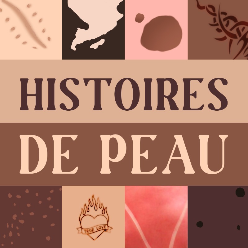 SanofiGenzymeFR's tweet photo. [#WorldADDay] "La #peau est à la croisée du regard des autres et de son propre regard intérieur" Dr Consoli nous apporte son éclairage sur la #DermatiteAtopique. Nous vous invitons à découvrir l’épisode 1 du podcast HISTOIRES DE PEAU. 
#MaintenantJagis #ChangeAD #Selfesteem
