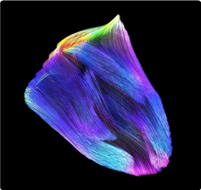 CIUS_NTNU's tweet photo. Advanced 3D #Doppler and high frame-rate #ultrasound imaging make it possible to visualise #cardiacflow and minor movements of the heart’s muscular tissue more precisely: https://t.co/TMWzSK8B49 https://t.co/kYyYgwqcP2