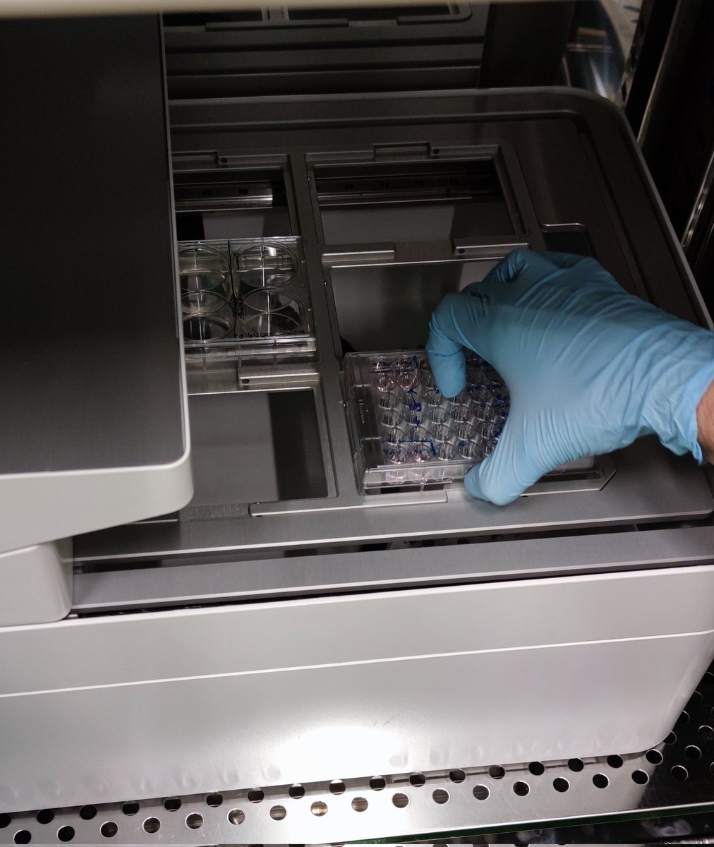 ghi_rwth's tweet photo. First trial of live cell imaging on the single crystalline SiC ceramics by #cellcyte 🧫🔬 Fingers crossed🤞
#bioceramics #cellculture #research @cytena @UniklinikAachen https://t.co/FQbDpylbB4