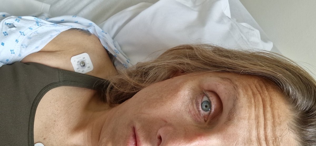 Emma78forlife's tweet photo. Et par døgn på kjeve og ansiktskirurgi avdelingen da🫣 https://t.co/3TRwcSUyBl