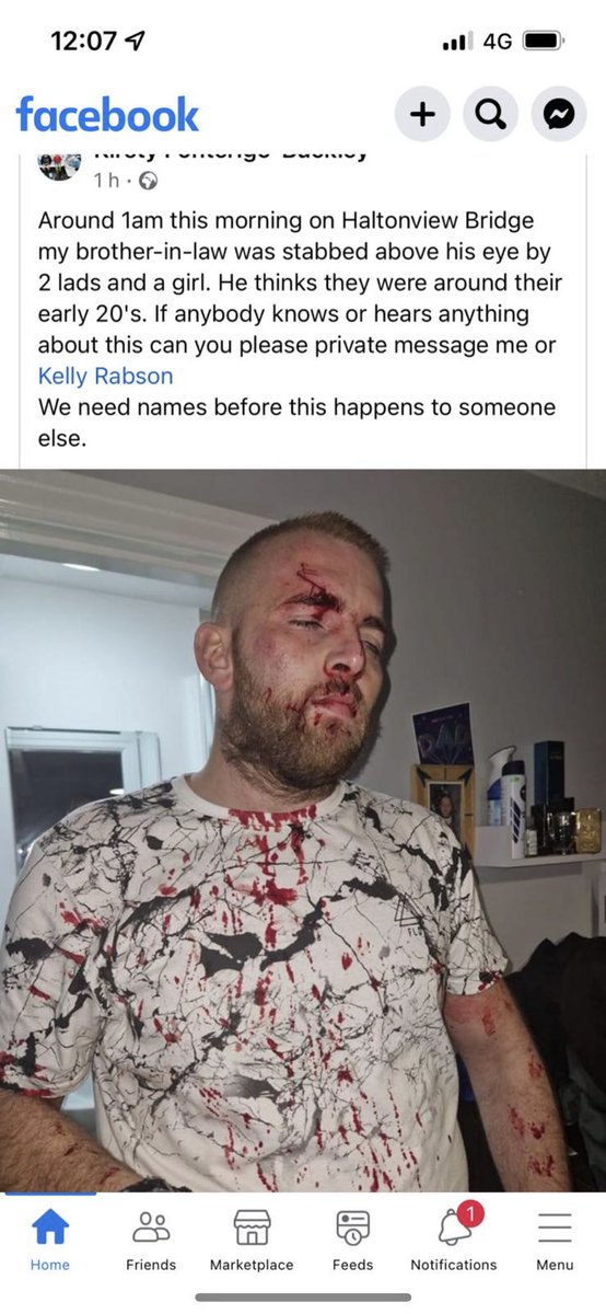 DiSGUSTING ATTACK if anyone has any information please contact myself or <a href="/PhilBuc17639884/">Phil Buckley</a>. Hope your okay mate.