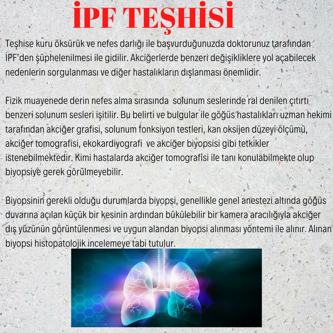 imunadir1's tweet photo. İPF'NİN TEŞHİS VE TEDAVİ YÖNTEMLERİ #idiyopatikpulmonerfibrozis #İPF #imünadir https://t.co/fAYzVI50Yj