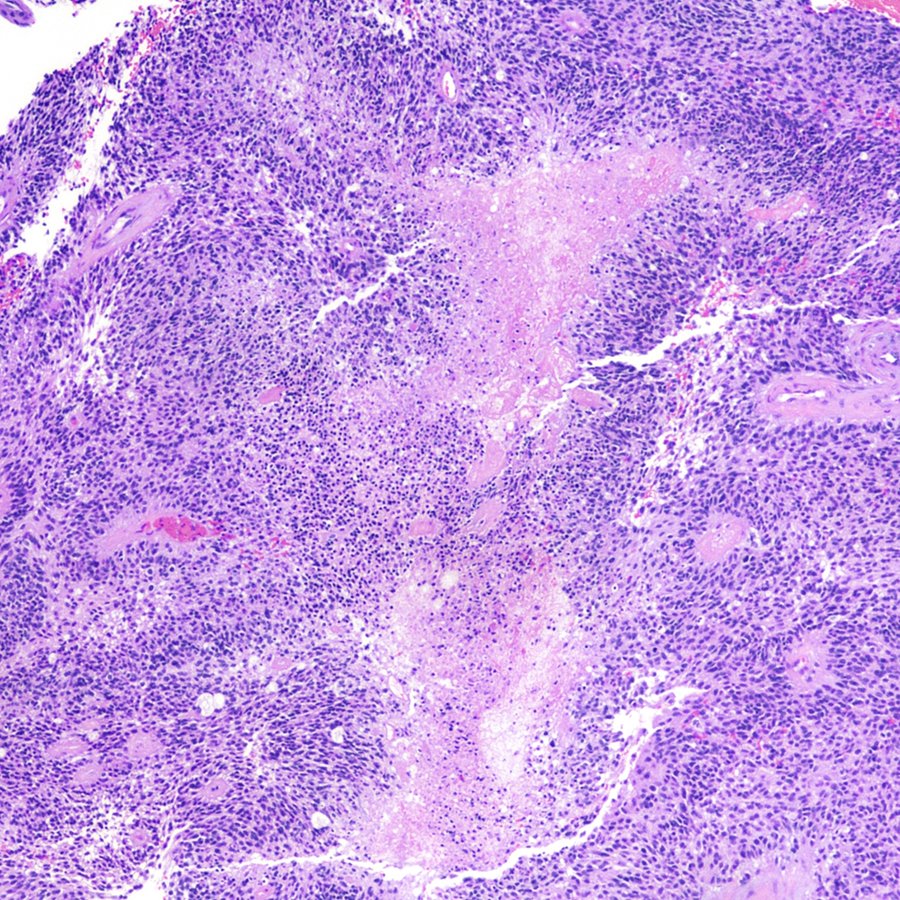 Craig Horbinski tweet media