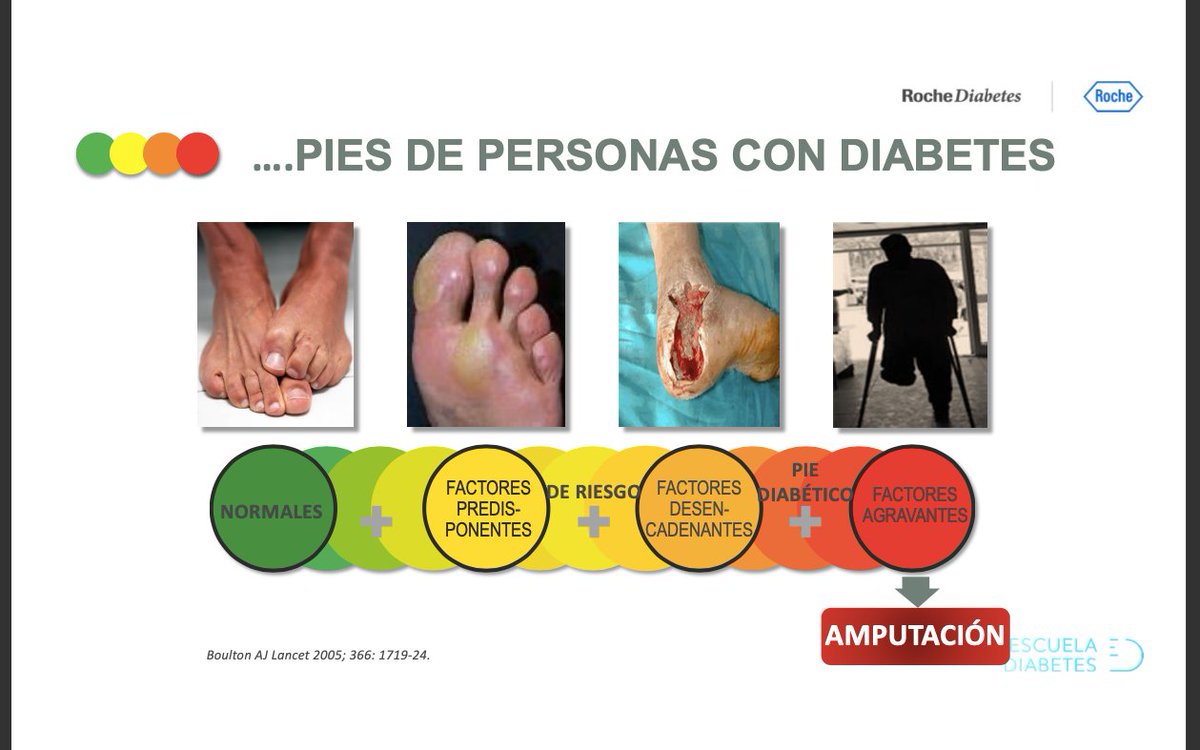 redGDPS's tweet photo. En el #piediabetico es fundamental conocer
⭕️ sus estadios,
📌 los mecanismos implicados para afrontar los 3 grandes retos
📍tomar conciencia de la importancia de la valoración del pie en el paciente con diabetes
@LlussaJ #PalomaPrat #ReginaMayor
#webgdps https://t.co/dWM6mEwOG4