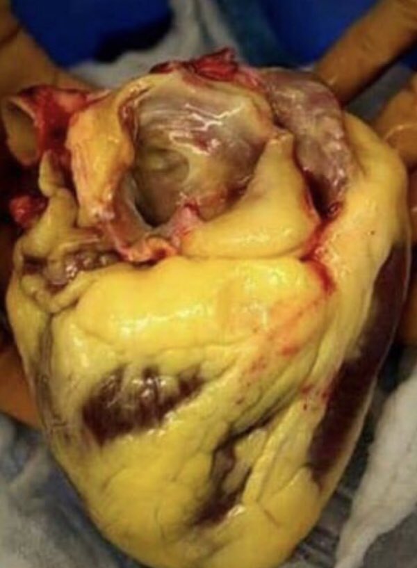 AdorniFactory's tweet photo. Corazón sano / Corazón de persona que se acepta tal como es, repudiando los estereotipos hegemónicos de belleza https://t.co/8mZBzmvJjx