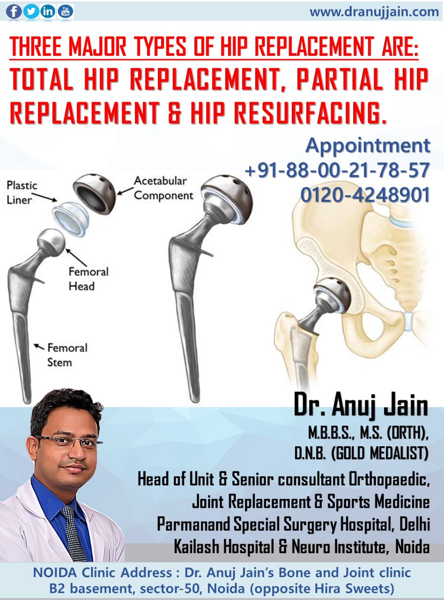 Dranujjainnoida's tweet photo. #Noida #Trending #delhihealth #blkmax #Fortis #hospital #hipsurgery #hipreplacement #sphdelhi
https://t.co/RTJ6TjYfx2 https://t.co/nglKjv8fFJ