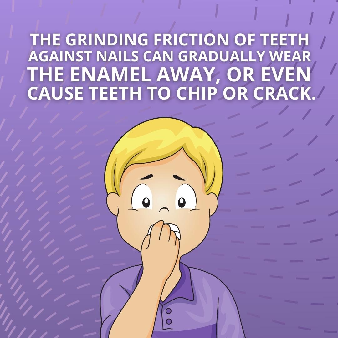 MesaDental's tweet photo. BITING NAILS CAN cause damage to your teeth so try your best to give up this habit if you struggle with it! #TeethDamage #SanDiegoDentist #MesaDental https://t.co/VA4WzWonwD